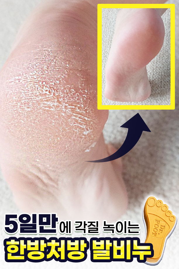 닥터풋 발비누, 110g, 1개 상세 이미지 3
