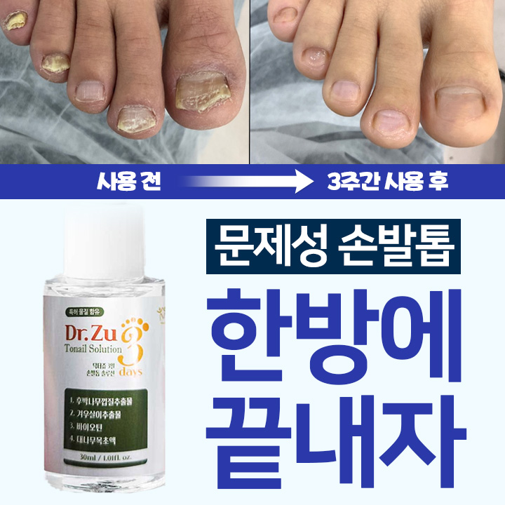 닥터쥬 3일 손발톱 솔루션, 30ml, 2개 상세 이미지 1