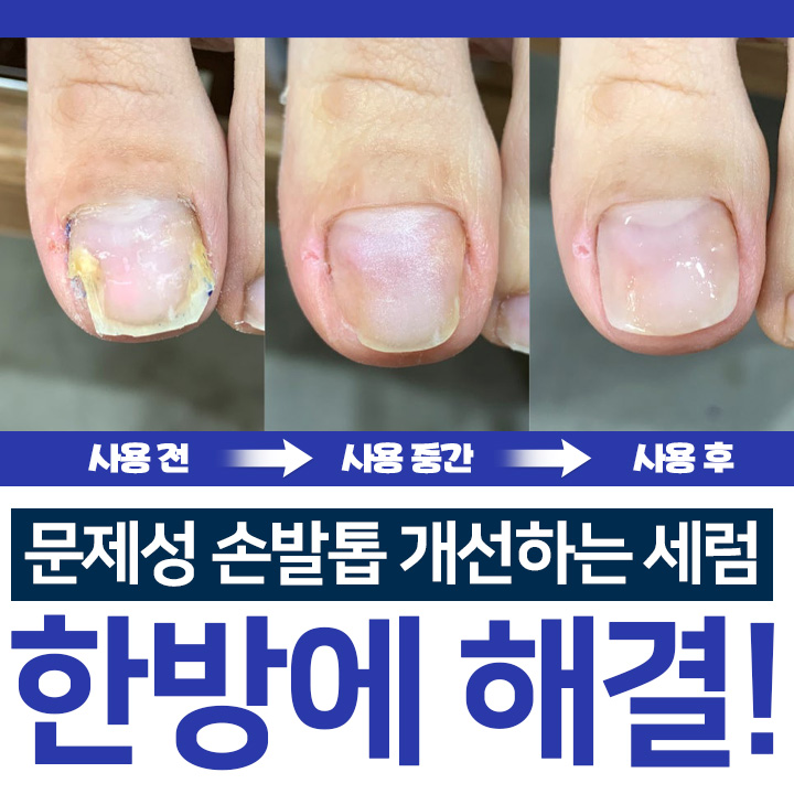 닥터쥬 3일 손발톱 솔루션, 30ml, 2개 상세 이미지 5