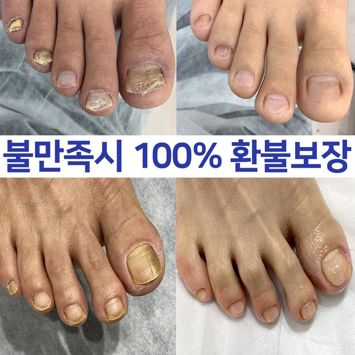 닥터쥬 3일 손발톱 솔루션, 30ml, 2개 상세 이미지 6