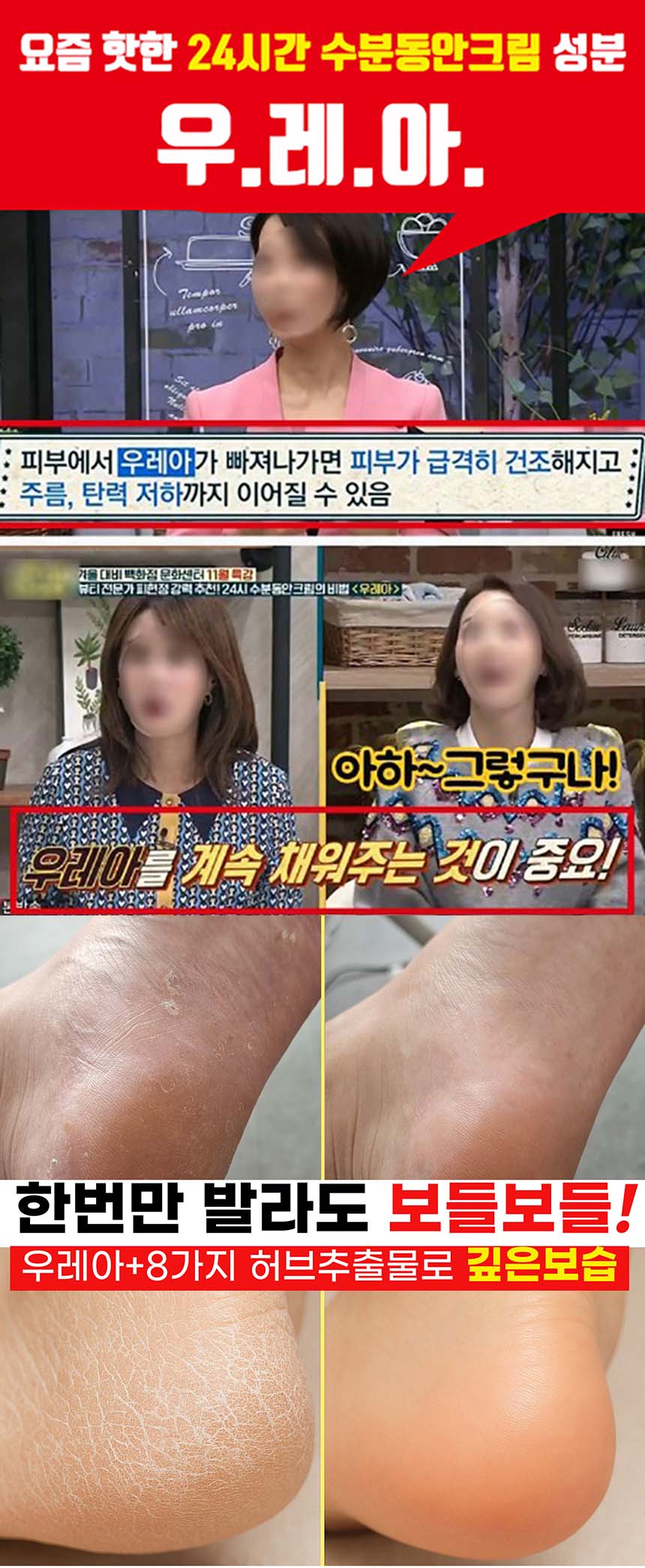 설수련 약국용 우레아 풋세럼, 100g 상세 이미지 4