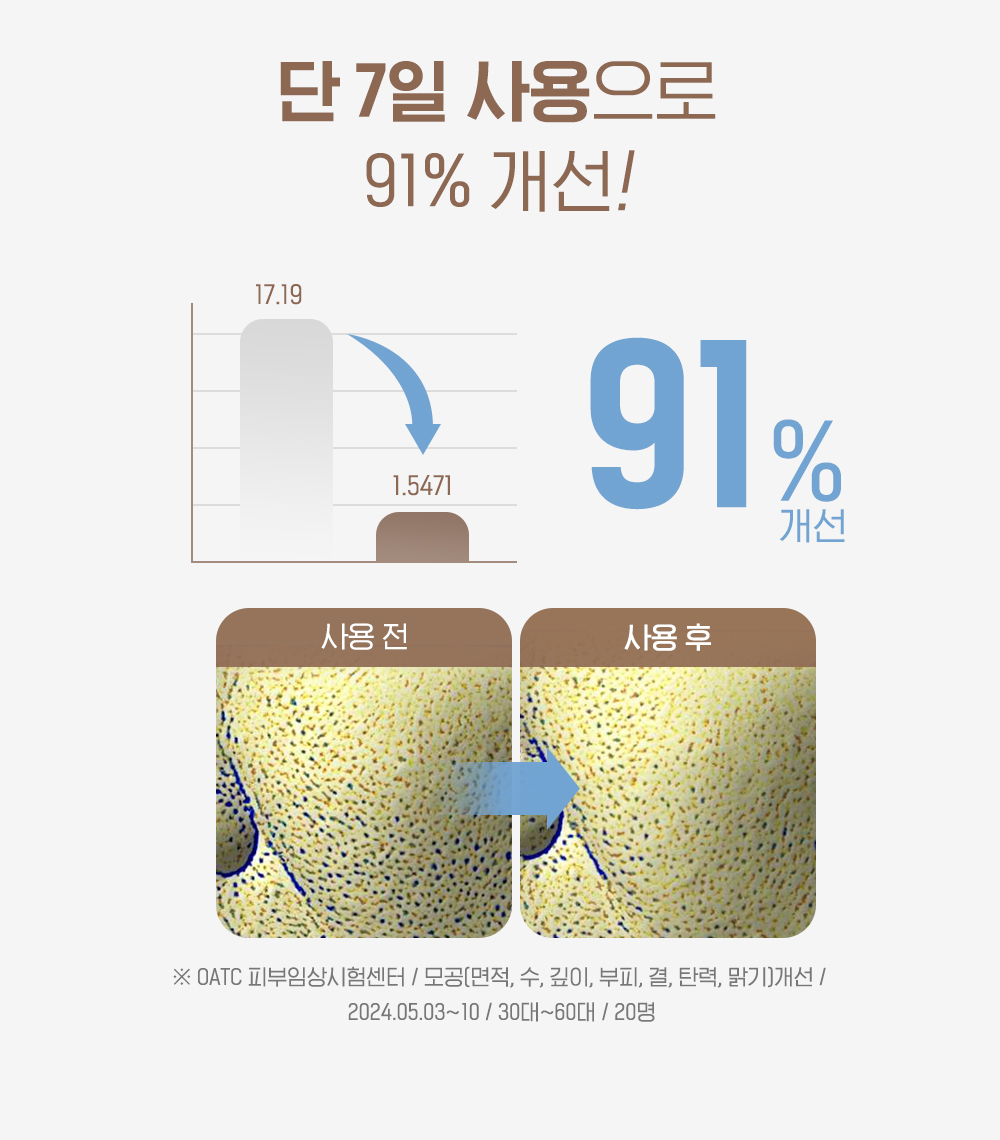 라오메뜨 전설의앰플 퍼펙트 사카로미세스, 100ml, 1개