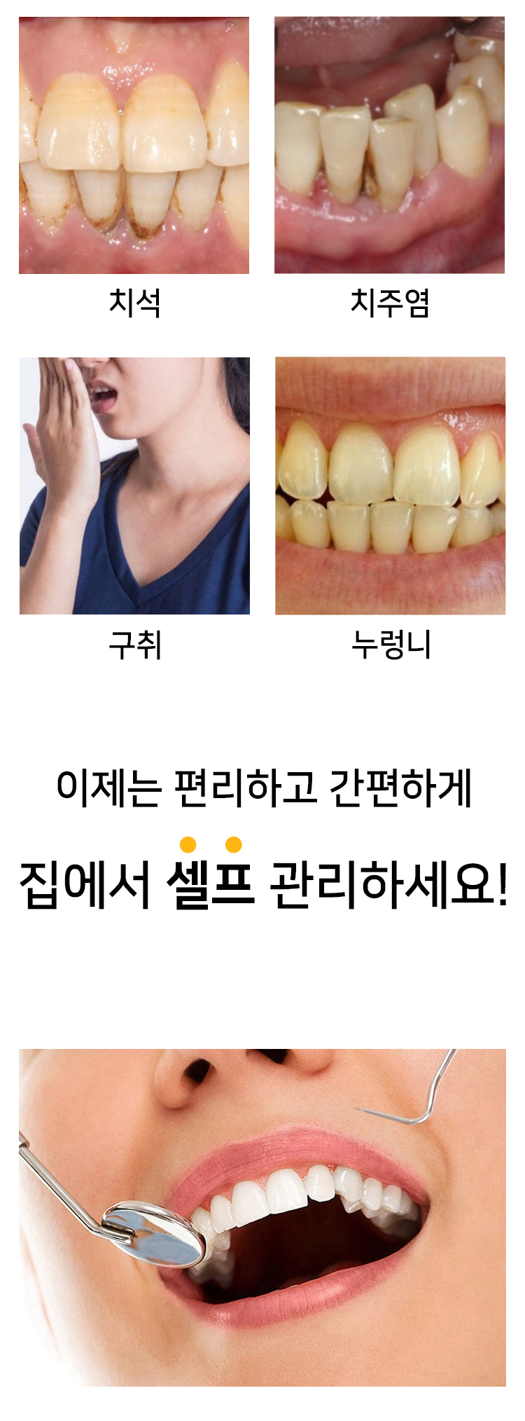 셀프 치아관리 세트, 1세트 상세 이미지 2