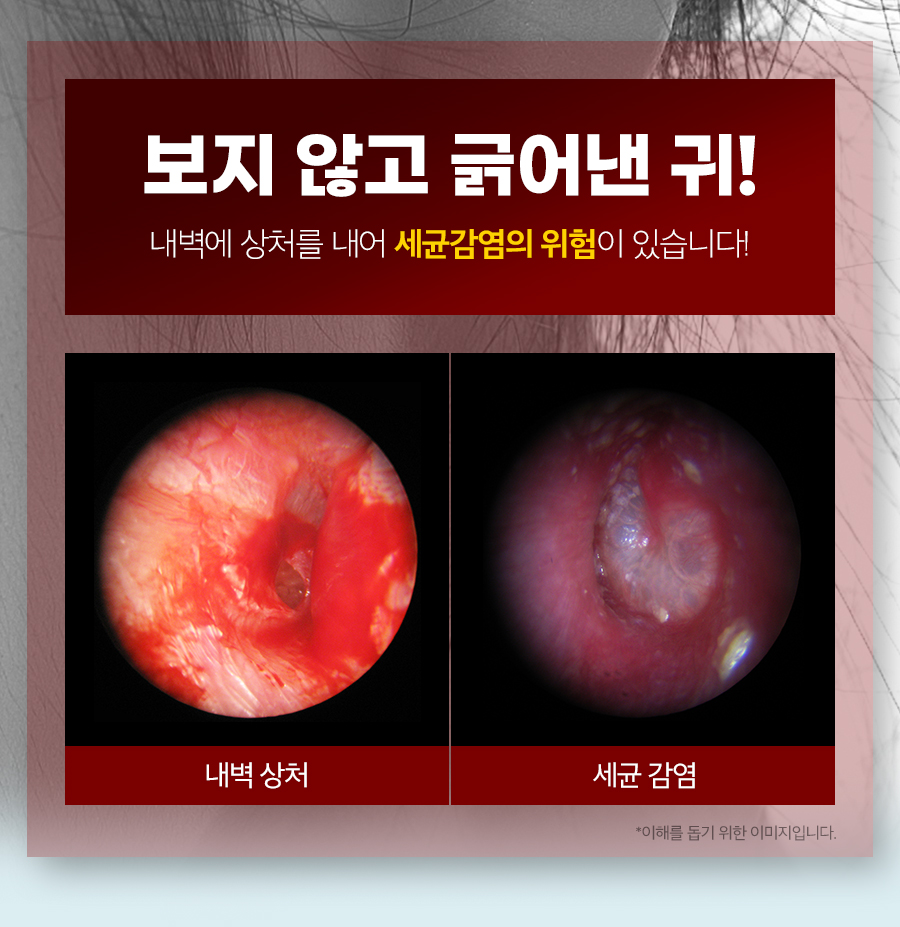 나무팩토리 내시경 귀이개, 2개 상세 이미지 3
