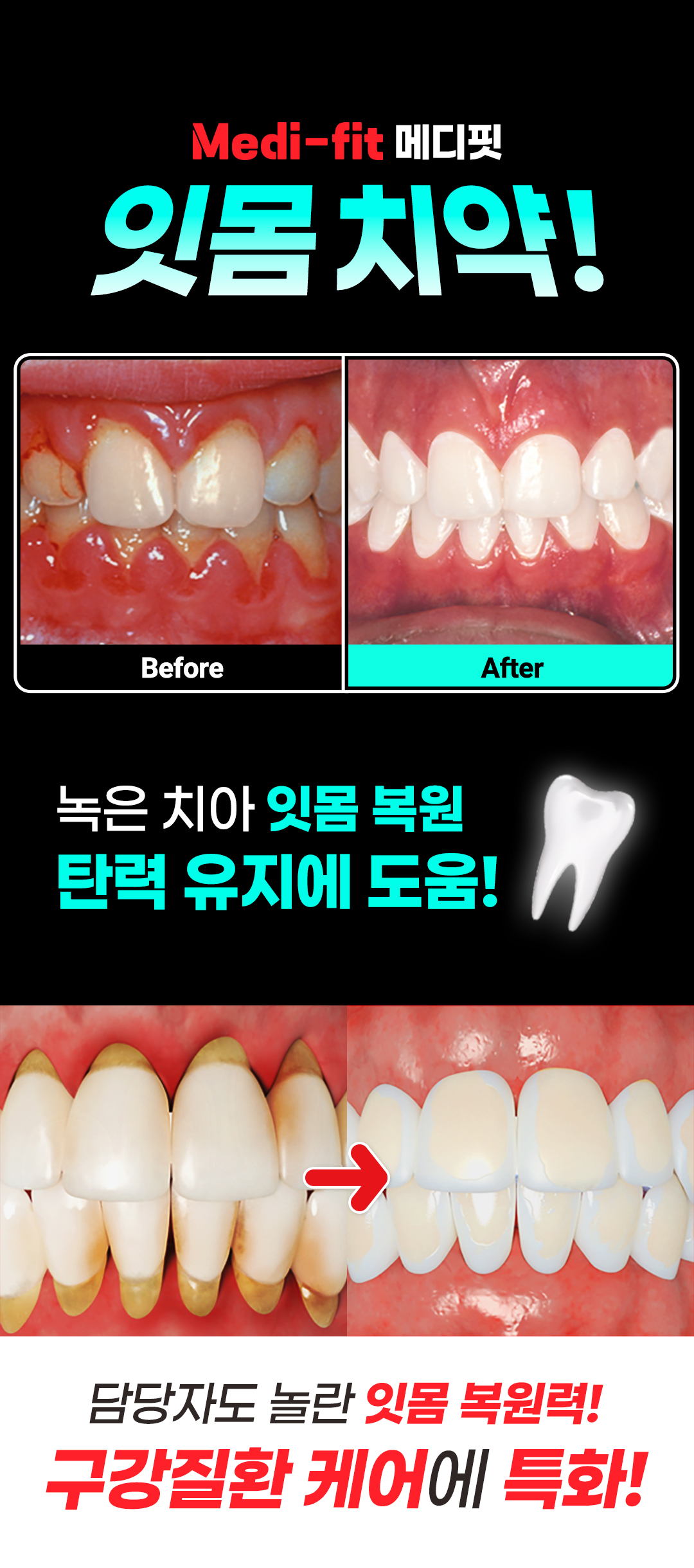 메디핏 잇몸치약, 120g, 4개 상세 이미지 3