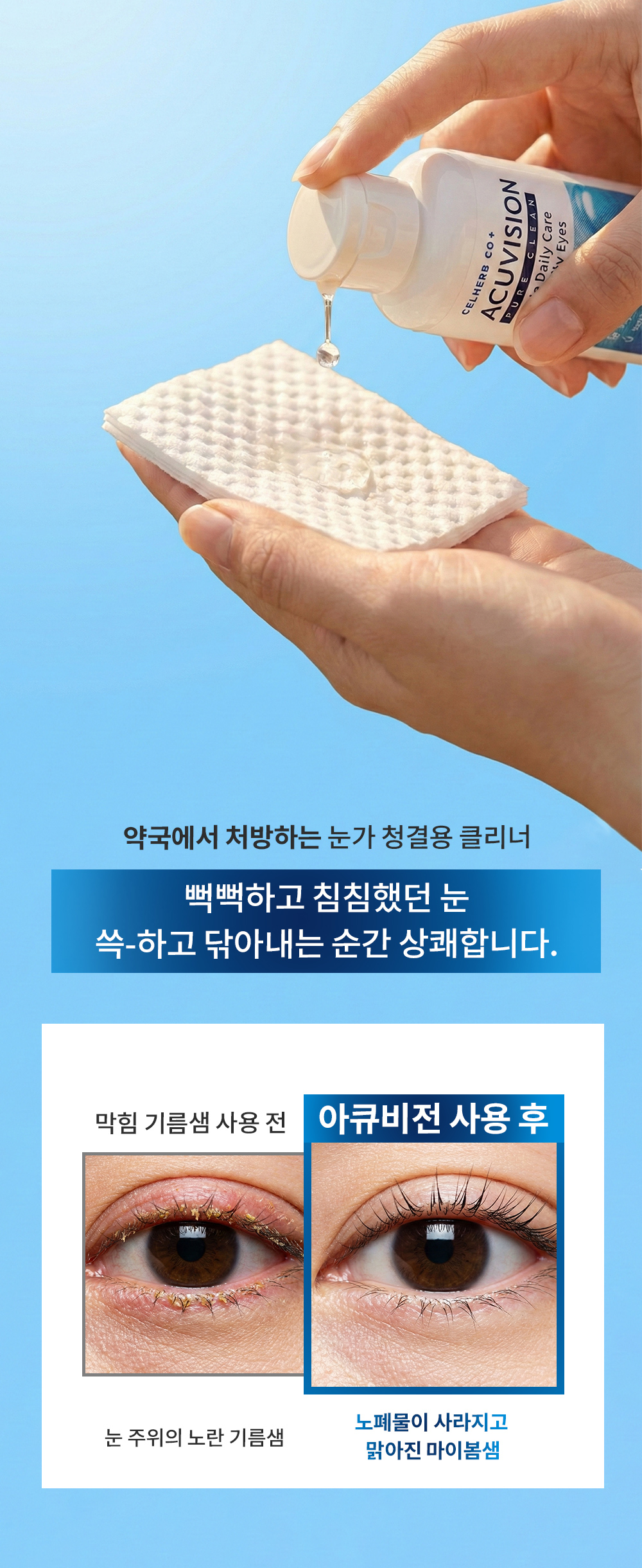 아큐비전 눈꺼풀 클렌저, 120ml, 2개 상세 이미지 5