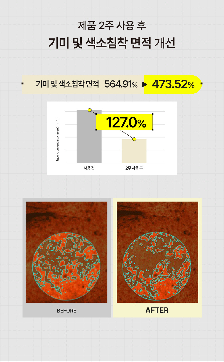 바이탈포션 슈퍼 글루타씨온 앰플, 18ml, 1개