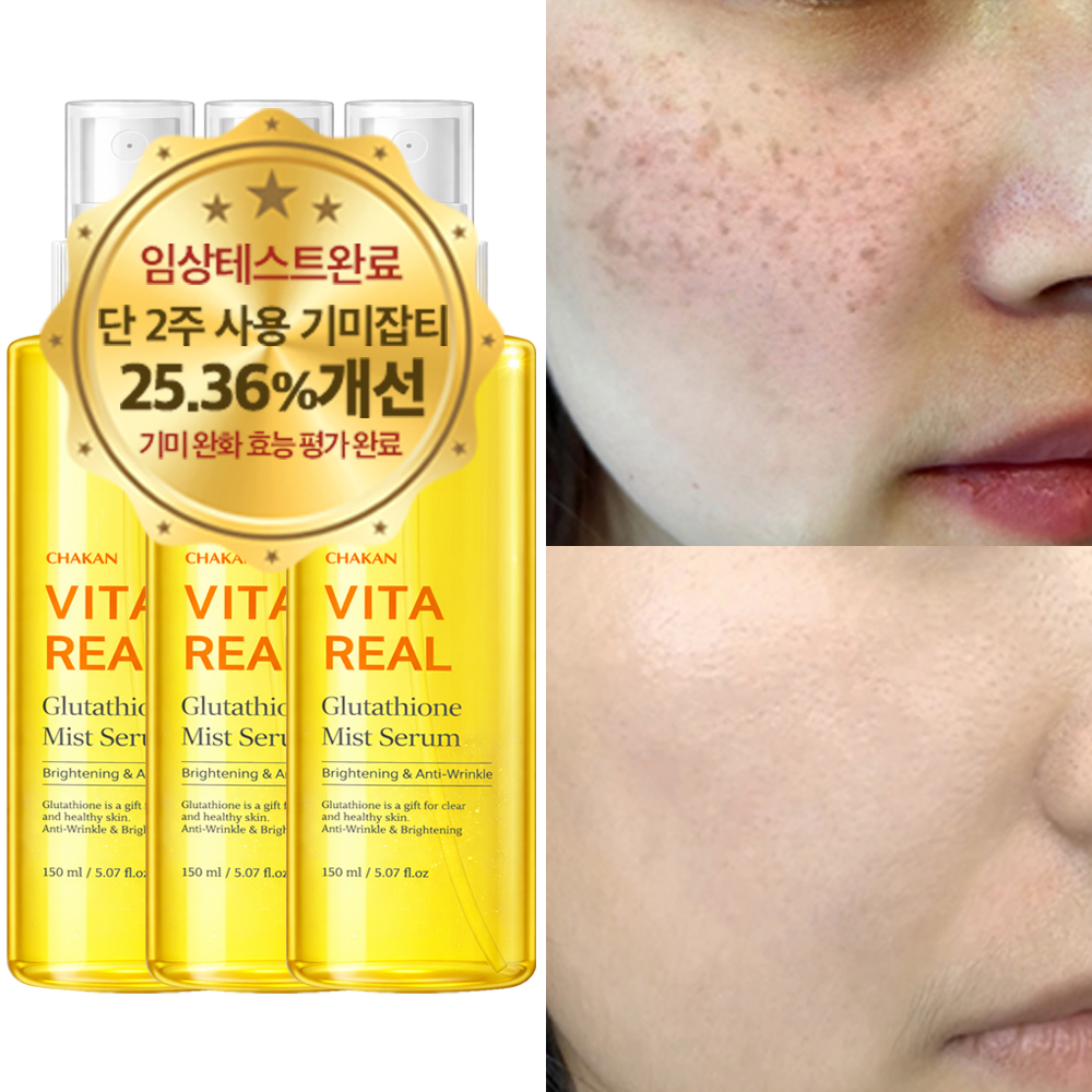 비타리얼 글루타치온 미스트 세럼, 150ml, 3개