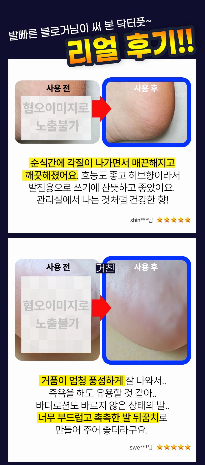 닥터풋 발비누, 110g, 1개 상세정보 7