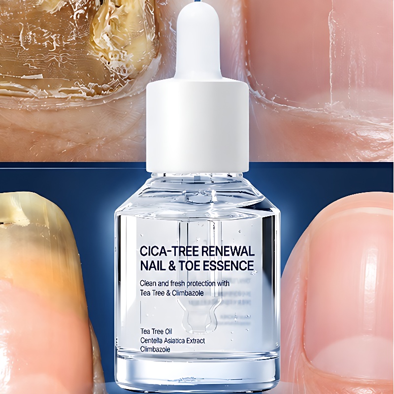 시카트리 네일에센스, 15ml, 1개입, 1병 상품 이미지 2